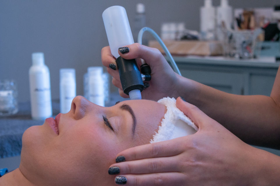 microdermabrasion facial yeovil